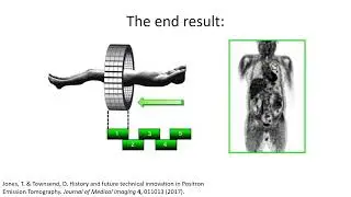 Minute Biophysics - Positron Emission Tomography (PET), Mark