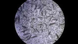 Video of Nanophyetus salmincola movement under the scope. (Video: Tamara Layden)