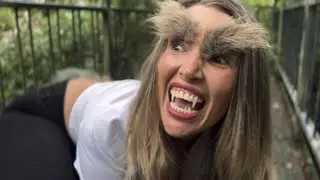 Werewolf Bite Transformed Me Into A Beast!