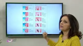 PUBERDADE TARDIA