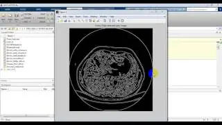 Automated system for lung nodules classification based on wavelet feature descriptor and SVM