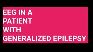EEG in generalised epilepsy - good video
