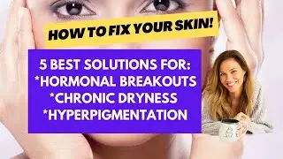 5 best solutions for aging skin: hormonal breakouts, dryness & hyperpigmentation!