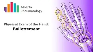 Rheumatology HAND exam: Palpation for Joint Swelling
