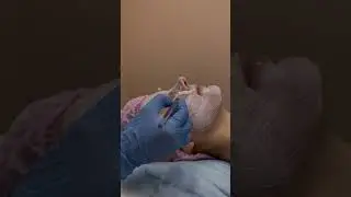 Комбинированная чистка лица