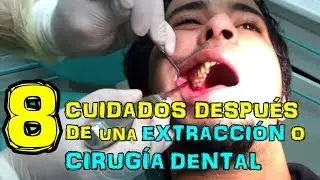 8 CUIDADOS DESPUÉS DE UNA EXTRACCIÓN O CIRUGÍA DENTAL -- Dr. Rod