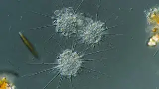 Heliozoans the Sun Animalcules