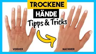 Tipps & Tricks Gegen TROCKENE HÄNDE