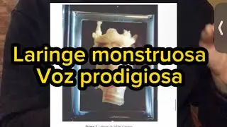 ¿Una laringe monstruosa puede dar lugar a una gran voz? Conoce a Julián Gayarre