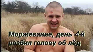 Моржевание, разбил голову об лёд.