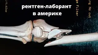 Учеба в Америке.  Профессия: Рентген-лаборант.