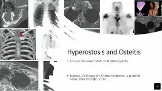 Old Diseases, New Developments