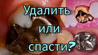 Удалить или спасти?
