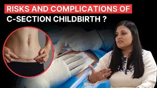 Risks and Complications of C Section