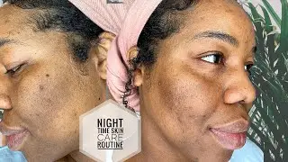 ✨My Nighttime Routine to Reduce Hyperpigmentation, Acne Scars, Pores, Blackhead and Dark Spots ✨