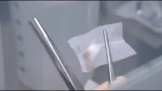 How is Larval Therapy Produced? | Your Questions Answered