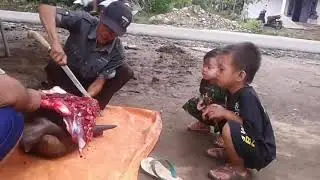 Otak di kepala berdarah-darah