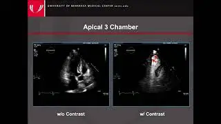 Guidelines for the Cardiac Sonographer in the Performance of Contrast Echo