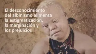 Exposición de fotografía 'Albino', de Ana Palacios, en la Universidad de Sevilla