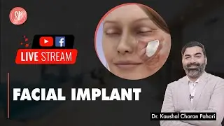 Facial Implant | Mid Face Implant | Face Implants #youtube #sbaesthetics #facialplasticsurgery