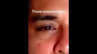 INNOCENT EYE#shortsvideo
