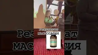 МАСТОПАТИЯ. Результат