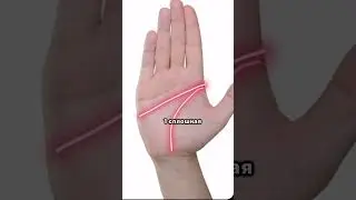 Обезьянья складка на ладони