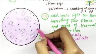 Gaint Cell Tumor Of Bone | Histopathology | Gross | Cut Section | Microscopy | Pathology