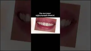 Проверьте свой прикус 