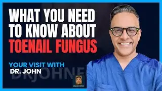 What You Need to Know About Toenail Fungus