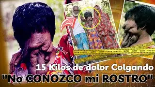 15 KILOS de dol0r Colgand0 de su ROSTRO la CONVIRTIERON en la MUJER sin ROSTRO de la india