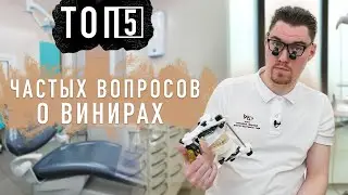 ТОП 5 самых ВАЖНЫХ вопросов о винирах - Что нужно знать?