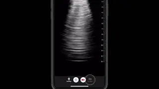 How To Use Lung Protocol | Butterfly Network