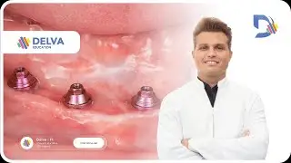 Imersão Protocolo Imediato 360º