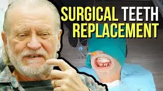 Dental Implant Treatment with 3 on 6 Provider in Las Vegas