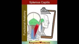 Headache at the top of the head - Splenius capitis trigger point