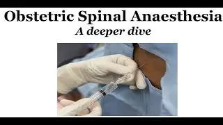 Obstetric Spinal Anaesthesia: A deeper dive