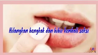 Cara Aman Mengatasi Bibir Bengkak agar Kembali Seksi