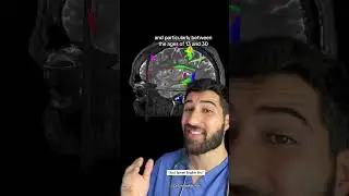 “Just Speak English Bro” 