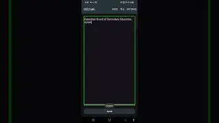 🔥 You Won’t Believe This New Text to Speech for Blind Users! 😱
