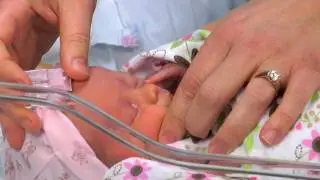 Giving eye drops to your baby