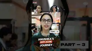 Acne Treatments and Solutions | Anti-Acne Journey | Juvena Herbals Client Testimonials | Part-3