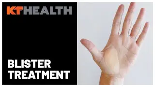 KT Health Blister Treatment Patch | Hydrocolloid Gel Technology