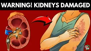 You Can't Believe These 9 Skin Signs Indicate Your KIDNEYS Are Damaged