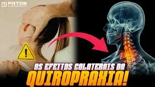 3 problemas da Quiropraxia que nunca te contaram!