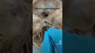 La silla turca y su relación con la glándula hipófisis o pituitaria