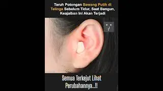 Taruh Potongan Bawang Putih di Telinga Sebelum Tidur, Saat Bangun, Keajaiban Ini Akan T