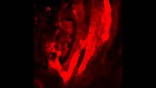 Real-time imaging of flow through the placental vasculature.