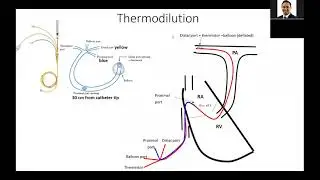Hemodynamics 2: cardiac output, mixed venous O2, shock indices- Elias Hanna, Univ Iowa