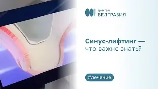 🔵​ Синус-лифтинг - что важно знать?